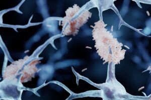 Thousands of people in China have had banned Alzheimer’s surgery